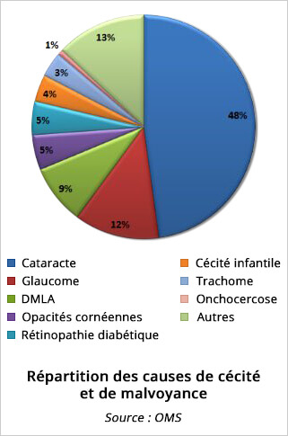 Répartition des causes de cécité et de malvoyance